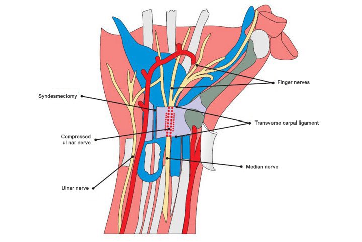 CTS-en.jpg (45 KB)